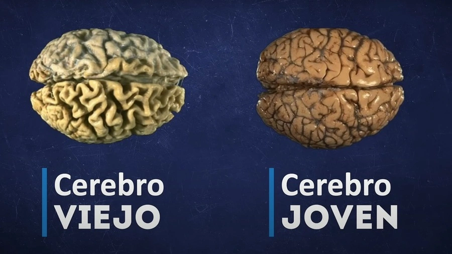 Comparación cerebro viejo - cerebro joven -Arándanos moras y nueces vitaminas para la memoria (incluímos recetas)- dralbuja.com