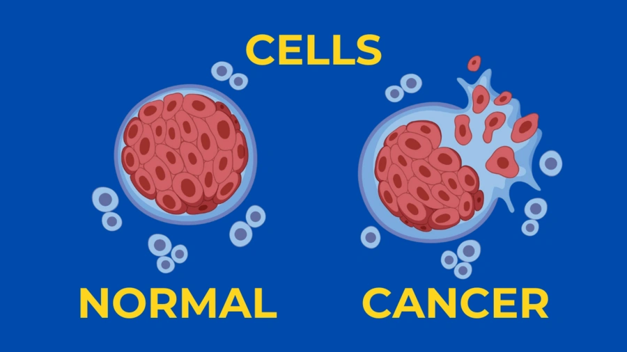 Todos Tenemos Celulas de Cancer en el estmago